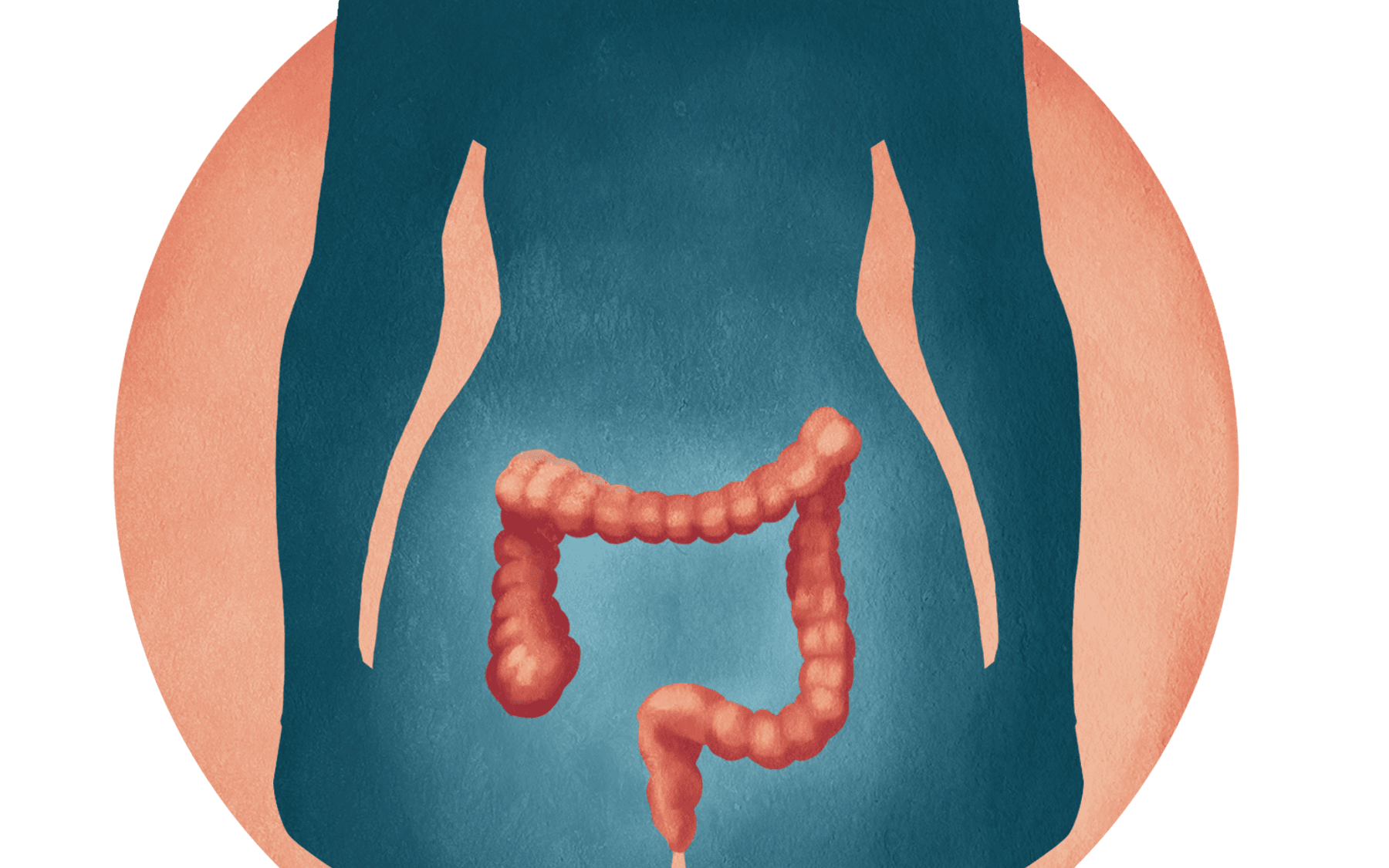 Myndskreyting með staðsetningu ristils og endaþarms í líkamanum